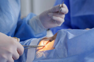 Oculoplastic Surgery in Vadodara